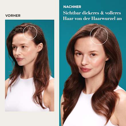 Scalp Serum ProGrowth + Peptide OGX