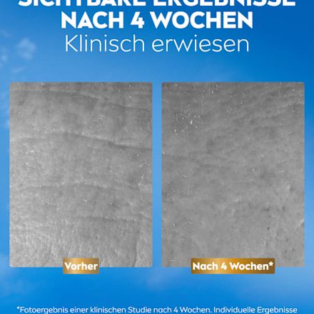 Gesichtscreme Q10 Anti-Falten Kollagen Experte Facial Butter Tag & Nacht  NIVEA