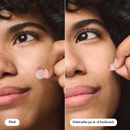 náplasti na akné Mighty Patch DUO - The ORIGINAL & INVISIBLE+ Hero.