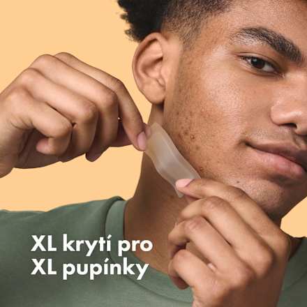 náplasti na akné Mighty Patch Surface Hero.