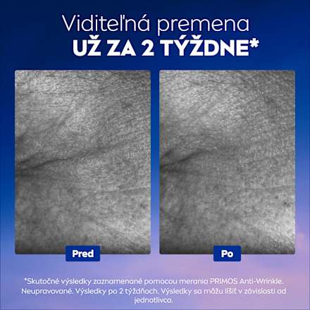 Omladzujúce pleťové sérum Cellular Epigenetics s Epicelline®  NIVEA