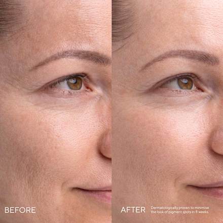 Pleťové sérum K Kojic Alternative  MÁDARA organic skincare