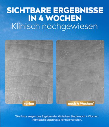 Gesichtscreme Q10 Anti-Falten Kollagen Experte Facial Butter Tag & Nacht  NIVEA