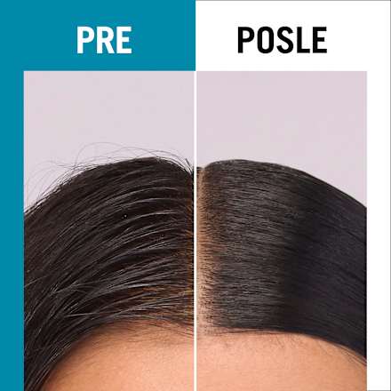 scalp balance PURIFYING SERUM - pročišćavajući serum za masno i teme koje se brzo masti Schwarzkopf GLISS