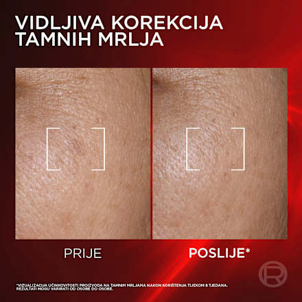 Anti-Aging serum za lice Revitalift Laser  L'ORÉAL PARiS REVITALIFT