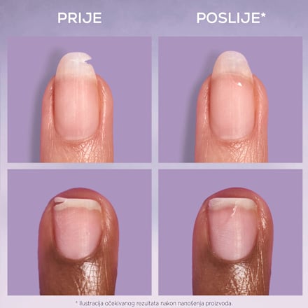Tekući flaster za nokte break fix essie