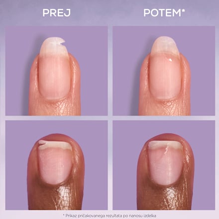 Lak za popravilo nohta break fix essie
