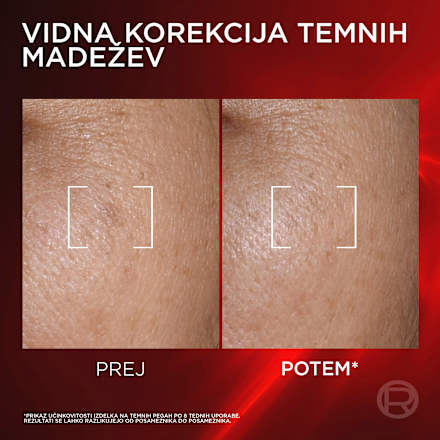 Kremni serum proti staranju Revitalift Laser L'ORÉAL PARiS REVITALIFT