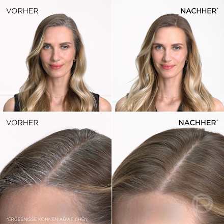 Ansatzspray Blond bis Mittelblond L'ORÉAL PARiS MAGIC RETOUCH
