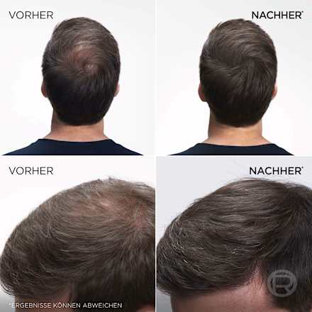 Ansatzspray Goldbraun L'ORÉAL PARiS MAGIC RETOUCH