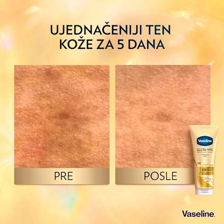 GLUTA-HYA FLAWLESS TONE losion za telo Vaseline
