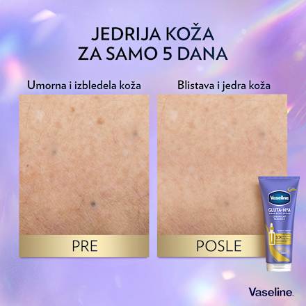 GLUTA-HYA OVERNIGHT RADIANCE serum za telo Vaseline