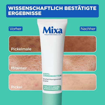 Anti Pickel Gesichtscreme korrigierend Mixa