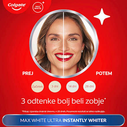 Zobna pasta Max White Ultra Colgate