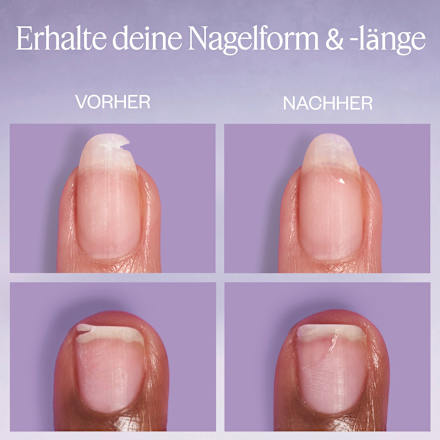 Nagelpflege Set Break Fix Nagelfixierer & On a roll Apricot Cuticle Oil essie