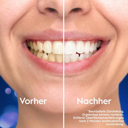 Zahnpasta Pro 3D White Clinical Intensive Whitening Oral-B