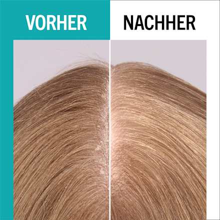 UV-Schutz Spray scalp balance LSF 20 Schwarzkopf GLISS