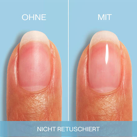 Nagelhärter Hard to resist advanced essie