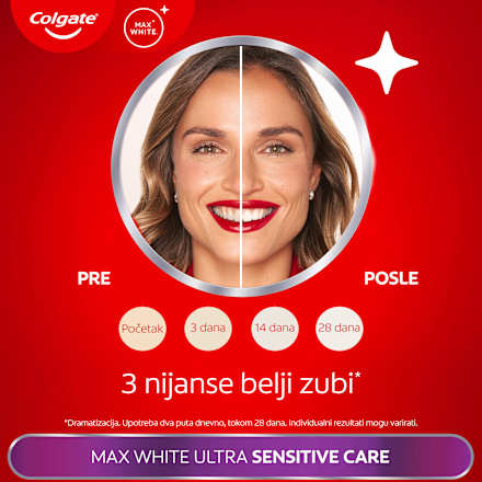 MAX WHITE ULTRA pasta za zube  Colgate