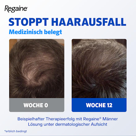 Regaine Männer 50 mg/ml Minoxidil Lösung (3x60 ml) Regaine