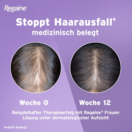 Regaine Frauen 20 mg/ml Minoxidil Lösung (3x60 ml) Regaine