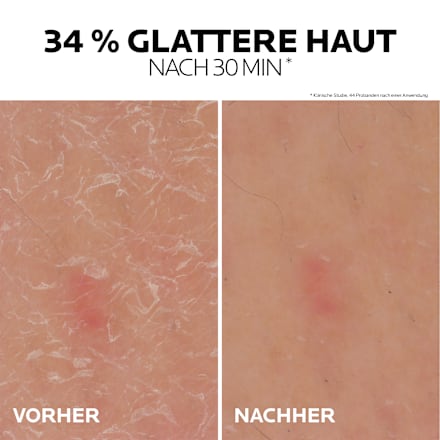 LA ROCHE-POSAY Lipikar Gel Urea 30% Anti-Verhornung LA ROCHE-POSAY