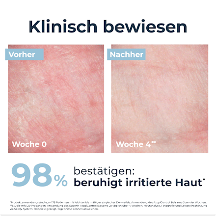 Eucerin Atopi Control beruhigender leichter Balsam Basispflege bei Neurodermitis Eucerin