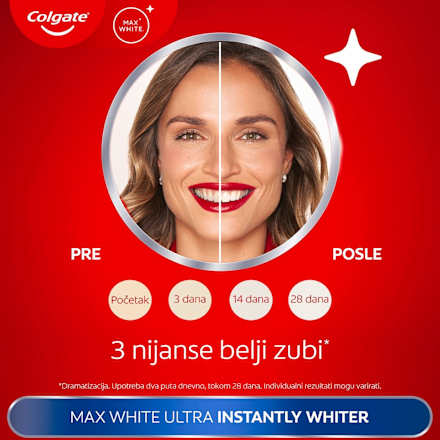 MAX WHITE ULTRA Instant Whiter pasta za zube Colgate
