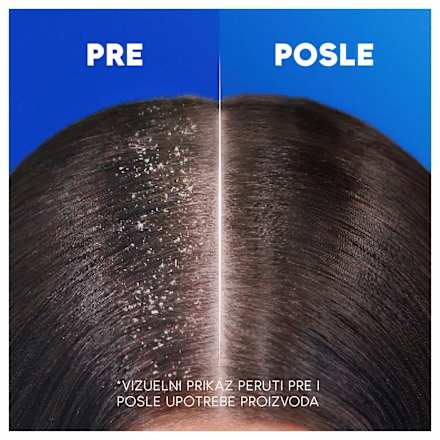 2in1 menthol Šampon za kosu head&shoulders