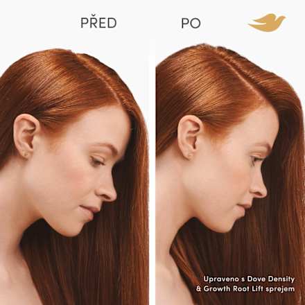 scalp hair therapy sprej pro objem vlasů Density & Growth Dove