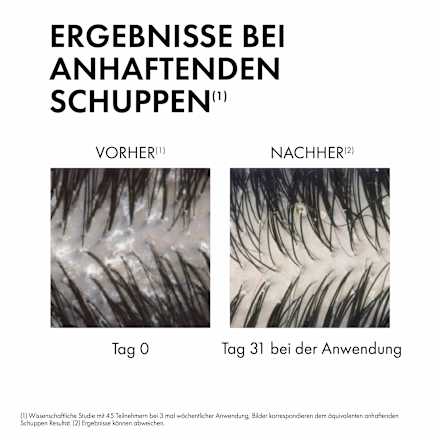 VICHY Dercos Anti-Schuppen Shampoo: Beruhigendes Shampoo mit Salicylsäure für normales bis fettiges Haar VICHY LABORATOIRES