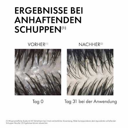 VICHY DERCOS Anti-Schuppen Shampoo normale-trockene Kopfhaut VICHY LABORATOIRES