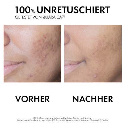 VICHY Normaderm Phytosolution Tagespflege VICHY LABORATOIRES
