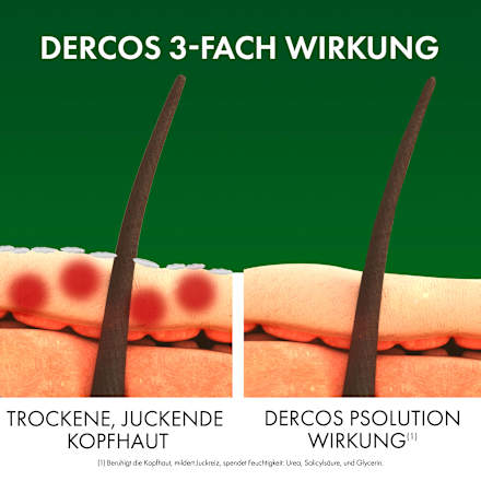 VICHY DERCOS PSOlution beruhigendes Shampoo gegen Schuppenflechte 5% Urea VICHY LABORATOIRES