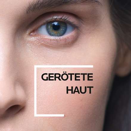 LA ROCHE-POSAY Toleriane Rosaliac AR Intensivpflege Creme LA ROCHE-POSAY