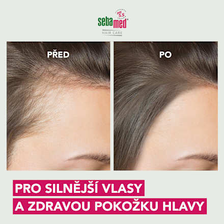 šampon na vlasy proti vypadávání sebamed