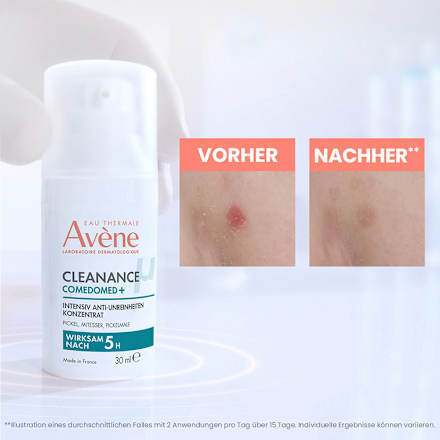 Avène Cleanance Comedomed+ Intensiv Anti-Unreinheiten Konzentrat Avène