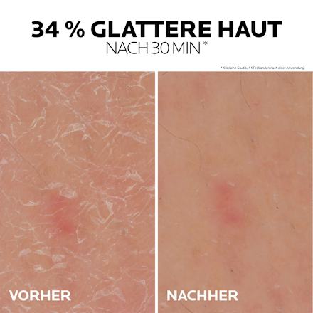 LA ROCHE-POSAY Lipikar Gel Urea 30% Anti-Verhornung LA ROCHE-POSAY