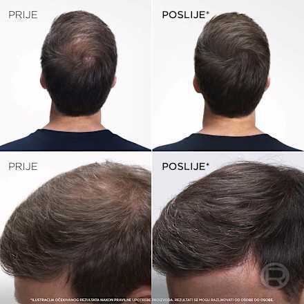 Sprej za prekrivanje izrasta Mahagony Brown L'ORÉAL PARiS MAGIC RETOUCH