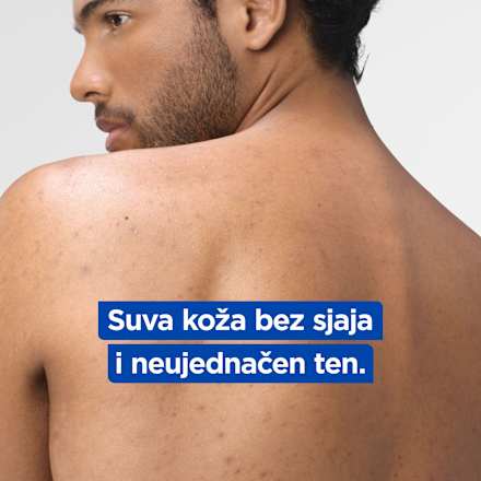 Losion za telo NIACINAMIDE BRIGHT Mixa