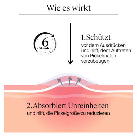 Anti-Pickel-Patches Sensitive Neutrogena